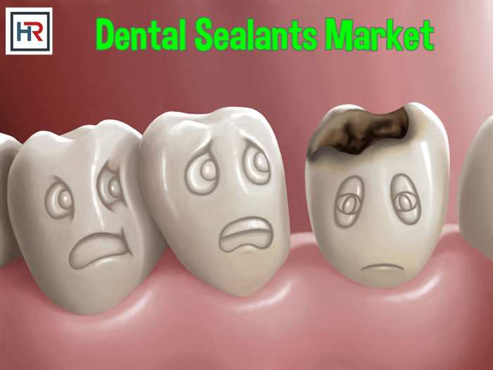 Dental Sealants Market .jpg